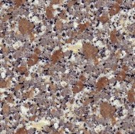 Rosa Limbara Granite