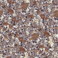 Rosa Sardo Limbara Granite